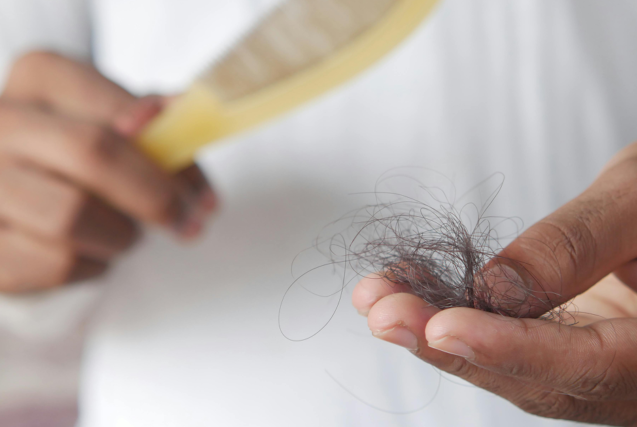 A close-up of a person holding a clump of fallen hair in their palm next to a hairbrush.