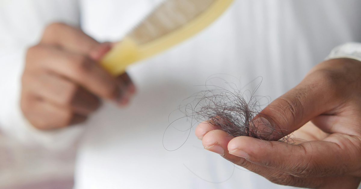 A close-up of a person holding a clump of fallen hair in their palm next to a hairbrush.